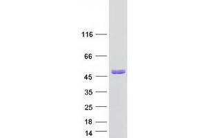 Validation with Western Blot
