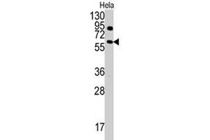 Western blot analysis of ANTXR1 polyclonal antibody  in HeLa cell line lysates (35 ug/lane).
