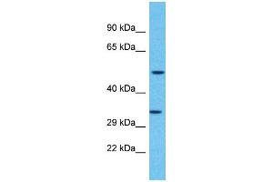 Western Blotting (WB) image for anti-Olfactory Receptor, Family 2, Subfamily F, Member 2 (OR2F2) (C-Term) antibody (ABIN2791722) (OR2F2 antibody  (C-Term))