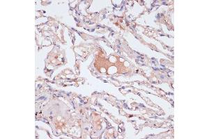 Immunohistochemistry of paraffin-embedded human lung using IFNG antibody (ABIN6128080, ABIN6142195, ABIN6142196 and ABIN6216082) at dilution of 1:100 (40x lens). (Interferon gamma antibody  (AA 24-166))