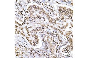 Immunohistochemistry (IHC) image for anti-CD38 (AA 1-300) antibody (ABIN1679089)