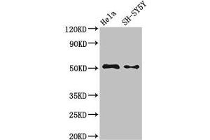 Western Blot Positive WB detected in: Hela whole cell lysate, SH-SY5Y whole cell lysate All lanes: FADS1 antibody at 3.