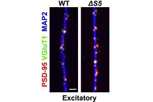 anti-Solute Carrier Family 17 (Vesicular Glutamate Transporter), Member 7 (SLC17A7) (AA 493-560), (C-Term), (Cytosolic) antibody