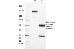 SDS-PAGE Analysis Purified CD21 / CR2 Mouse Monoclonal Antibody (CR2/1953). (CD21 antibody  (AA 44-196))