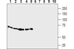 Western blot analysis of  Human THP-1  acute monocytic leukemia cells (lanes 1 and 6),  mouse WEHI-231 B-cell lymphoma cells (lanes 2 and 7), rat RBL basophilic leukemia cells lysates (lanes 3 and 8), rat heart (lanes 4 and 9) and rat lung membranes (lanes 5 and 10): - 1-5. (SLC7A2 antibody  (2nd Extracellular Loop))