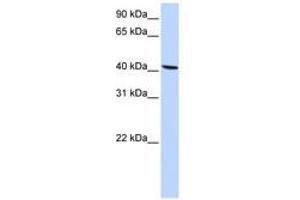 Image no. 1 for anti-Solute Carrier Family 22 Member 18 (SLC22A18) (AA 108-157) antibody (ABIN6740843) (ORCTL-2/SLC22A18 antibody  (AA 108-157))