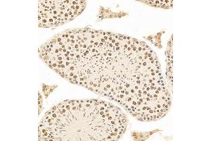 Immunohistochemistry (Paraffin-embedded Sections) (IHC (p)) image for anti-Polymerase (DNA-Directed), delta 3, Accessory Subunit (POLD3) antibody (ABIN7075130)