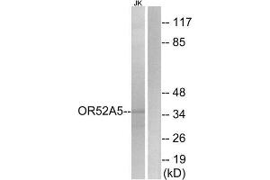 Western Blotting (WB) image for anti-Olfactory Receptor 52A5 (OR52A5) (Internal Region) antibody (ABIN1853402) (OR52A5 antibody  (Internal Region))