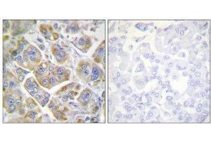 Immunohistochemistry (IHC) image for anti-Integrin beta 4 (ITGB4) (Tyr1510) antibody (ABIN5976199) (Integrin beta 4 antibody  (Tyr1510))