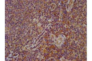 IHC image of ABIN7152326 diluted at 1:600 and staining in paraffin-embedded human lymph node tissue performed on a Leica BondTM system. (FAM62B antibody  (AA 567-736))