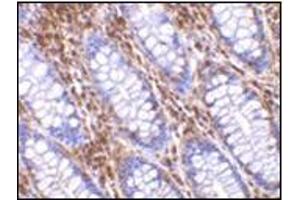 Immunohistochemistry of OMI in human colon tissue with this product at 10 μg/ml. (HTRA2 antibody  (C-Term))