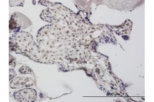 Immunoperoxidase of monoclonal antibody to DCPS on formalin-fixed paraffin-embedded human placenta. (DCPS antibody  (AA 1-337))