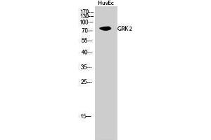 Western Blotting (WB) image for anti-Adrenergic, Beta, Receptor Kinase 1 (ADRBK1) (Ser129) antibody (ABIN3184941) (GRK2 antibody  (Ser129))