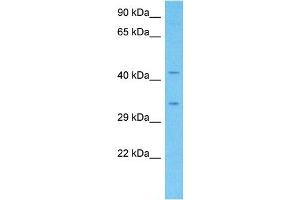 Host:  Rabbit  Target Name:  CAMLG  Sample Type:  Fetal Liver lysates  Antibody Dilution:  1. (CAMLG antibody  (C-Term))