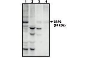 Image no. 1 for anti-SH3-Domain Binding Protein 2 (SH3BP2) antibody (ABIN291998)