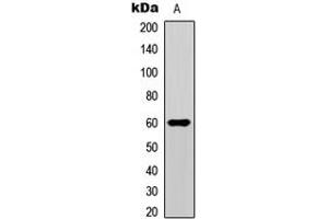 Western blot analysis of SMAD1/9 (pS465/467) expression in HeLa (A) whole cell lysates. (Smad1/9 antibody  (C-Term, pSer465, pSer467))
