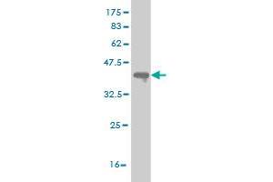 Western Blot detection against Immunogen (36. (PRKG1 antibody  (AA 73-170))