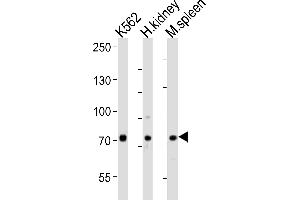 Western blot analysis of lysates from K562 cell line, human kidney, mouse spleen tissue (from left to right), using SDAD1 Antibody (C-term) (ABIN6244145 and ABIN6577730).