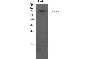 Western Blotting (WB) image for anti-LIM Domain Kinase 1 (LIMK1) (Internal Region) antibody (ABIN3185384) (LIM Domain Kinase 1 antibody  (Internal Region))