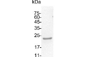 Thyroid Peroxidase (TPO) (Active) protein (His tag)