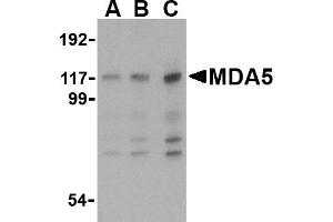 Western blot analysis of MDA5 in Daudi cell lysate with MDA5 antibody at (A) 1, (B) 2 and (C) 4 µg/mL.