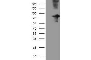 Western Blotting (WB) image for anti-Oxysterol Binding Protein-Like 11 (OSBPL11) antibody (ABIN1499923) (OSBPL11 antibody)