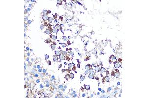 Immunohistochemistry of paraffin-embedded rat testis using WISP2 Rabbit pAb (ABIN6128929, ABIN6150227, ABIN6150229 and ABIN6223338) at dilution of 1:100 (40x lens). (WISP2 antibody  (AA 1-250))