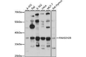Western blot analysis of extracts of various cell lines, using RNB antibody (ABIN6133304, ABIN6146990, ABIN6146991 and ABIN6220814) at 1:3000 dilution. (RNASEH2B antibody  (AA 1-290))