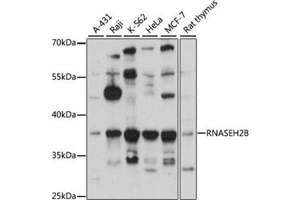 RNASEH2B 抗体  (AA 1-290)