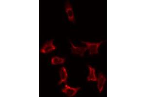 Immunofluorescence (fixed cells) (IF/ICC) image for anti-Solute Carrier Family 25 (Mitochondrial Carrier, Adenine Nucleotide Translocator), Member 31 (SLC25A31) (Internal Region) antibody (ABIN6258664)