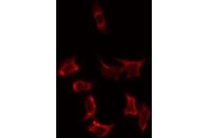 ABIN6274814 staining HeLa by IF/ICC. (SLC25A31 antibody  (Internal Region))