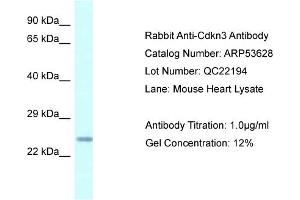 Western Blotting (WB) image for anti-Cyclin-Dependent Kinase Inhibitor 3 (CDKN3) (N-Term) antibody (ABIN970374) (CDKN3 antibody  (N-Term))
