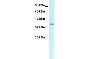 Western Blotting (WB) image for anti-Chemokine-Like Receptor 1 (CMKLR1) antibody (ABIN2460102)