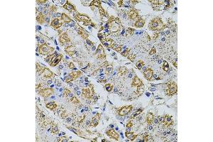 Immunohistochemistry of paraffin-embedded human stomach using GM13125 antibody (ABIN6127294, ABIN6141172, ABIN6141175 and ABIN6216319) at dilution of 1:100 (40x lens). (Pramel15 antibody  (AA 1-477))