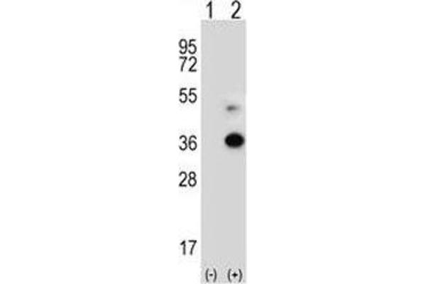 ANGPTL7 antibody  (AA 300-350)