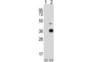 Western blot analysis of ANGPTL7 antibody and 293 cell lysate either nontransfected (Lane 1) or transiently transfected (2) with the ANGPTL7 gene.