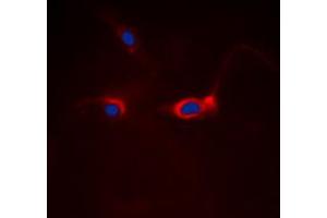 Immunofluorescent analysis of FOXO1 staining in Hela cells. (FOXO1 antibody  (Center))