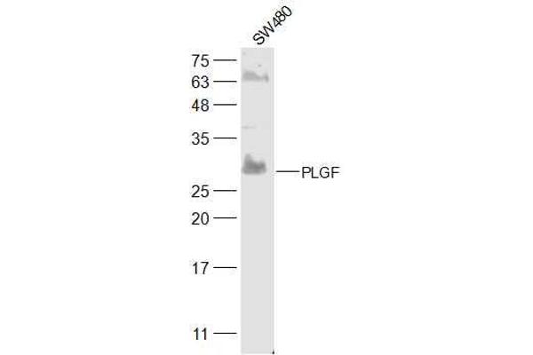 PLGF Antikörper  (AA 166-221)