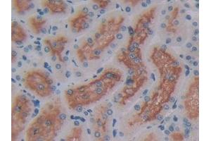Detection of ENPEP in Rat Kidney Tissue using Polyclonal Antibody to Aminopeptidase A (ENPEP) (ENPEP antibody  (AA 409-624))