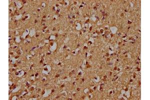 IHC image of ABIN7176307 diluted at 1:300 and staining in paraffin-embedded human brain tissue performed on a Leica BondTM system. (ZFP42 antibody  (AA 50-256))
