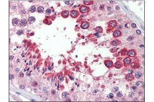 Testis, Human: Formalin-Fixed, Paraffin-Embedded (FFPE) (Reticulon 4 antibody)