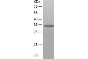 Western Blotting (WB) image for Methylenetetrahydrofolate Dehydrogenase (NADP+ Dependent) 2, Methenyltetrahydrofolate Cyclohydrolase (MTHFD2) (AA 30-350) protein (His tag) (ABIN7285389) (MTHFD2 Protein (AA 30-350) (His tag))