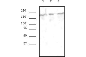 SMARCA4 antibody (mAb) (Clone 5B7) tested by Western blot. (SMARCA4 antibody  (AA 213-295))