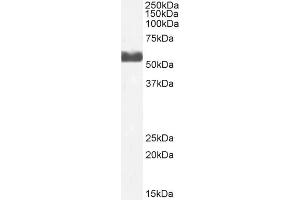 ABIN6391374 (2µg/ml) staining of Human Liver lysate (35µg protein in RIPA buffer). (CYP2D6 antibody  (C-Term))
