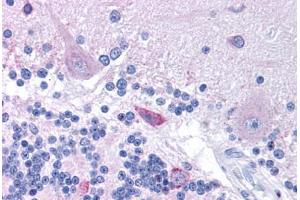 Human Brain, Cerebellum (formalin-fixed, paraffin-embedded) stained with HTR3B antibody ABIN214778 at 5 ug/ml followed by biotinylated goat anti-rabbit IgG secondary antibody ABIN481713, alkaline phosphatase-streptavidin and chromogen. (Serotonin Receptor 3B antibody  (N-Term))