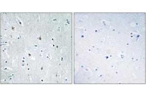 Immunohistochemistry analysis of paraffin-embedded human brain tissue, using SOX12 Antibody.
