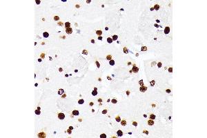 Immunohistochemistry (IHC) image for anti-Heterogeneous Nuclear Ribonucleoprotein D (HNRNPD) (AA 1-306) antibody (ABIN7267632)
