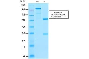 SDS-PAGE Analysis Purified Ferritin LC Rabbit Recombinant Monoclonal Antibody (FTL/2338R). (Recombinant FTL antibody  (AA 38-165))