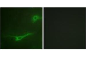 Immunofluorescence analysis of NIH-3T3 cells, using MUNC-18a (Ab-313) Antibody.