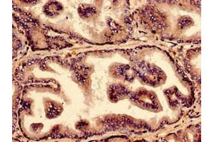 Immunocytochemistry analysis of human prostate tissue using ABIN7161840 at dilution of 1:100 (NUP214 antibody  (AA 28-238))